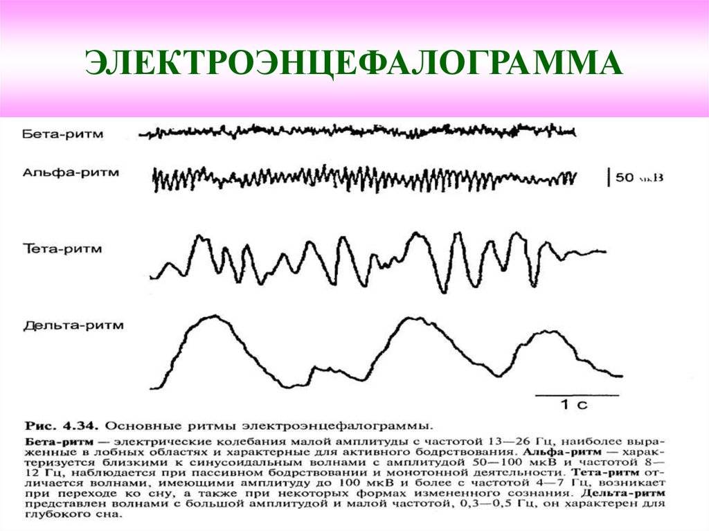 Диффузная тета активность. Расшифровка показателей электроэнцефалограммы ЭЭГ головного мозга. ЭЭГ головного мозга ребенку показателе в норме. ЭЭГ нормальные показатели у подростка. ЭЭГ головного мозга ребенка расшифровка показателей норма.